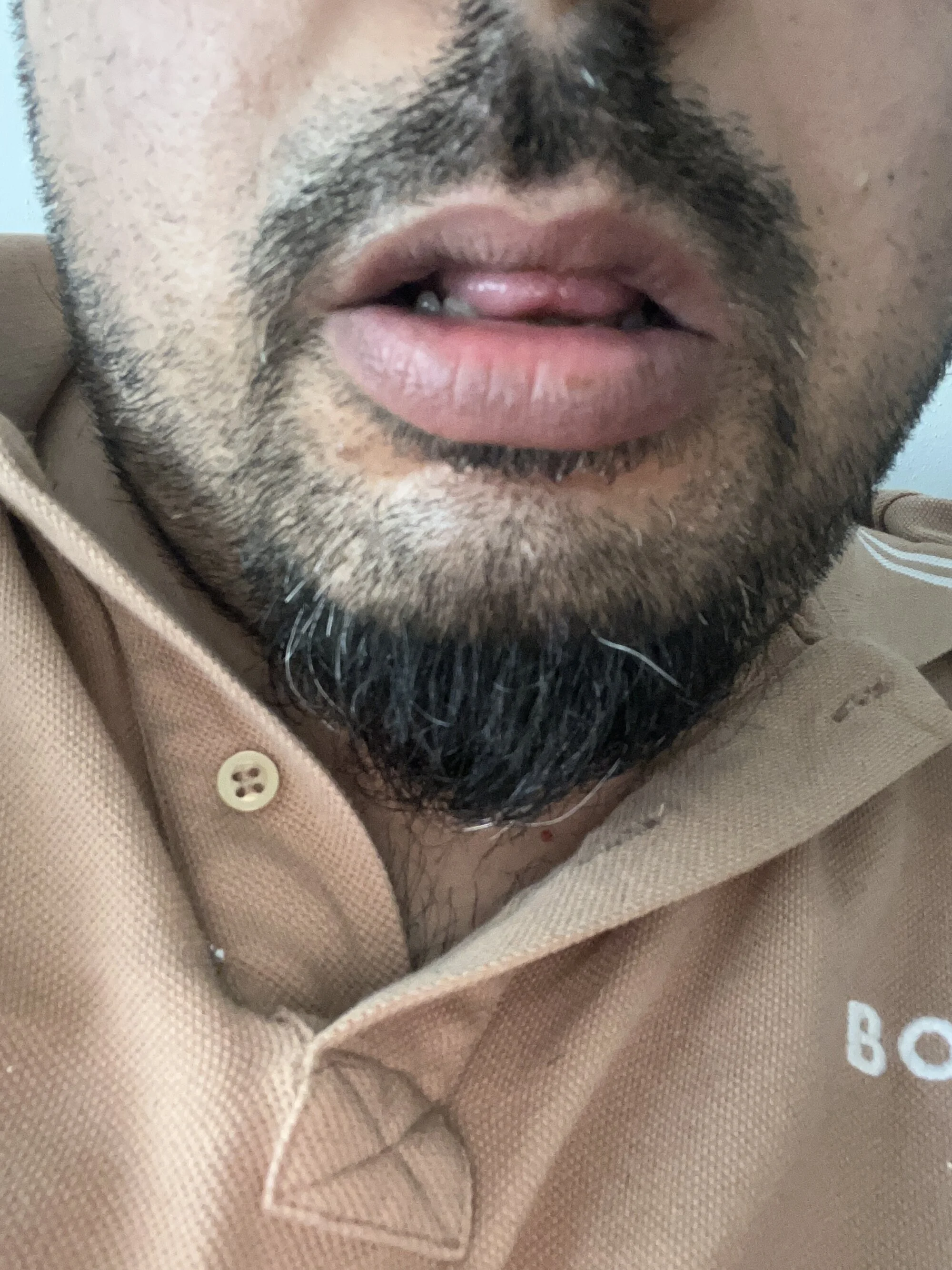 Sikici710000