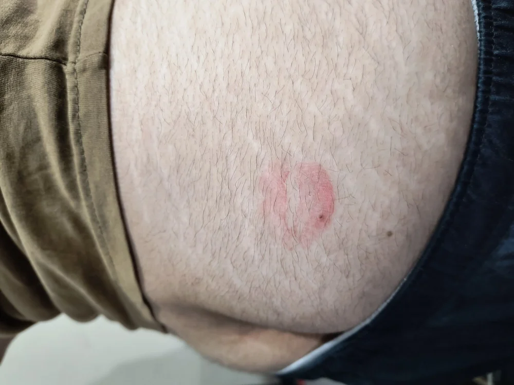 Duxdroid Obrolan XXX Offline