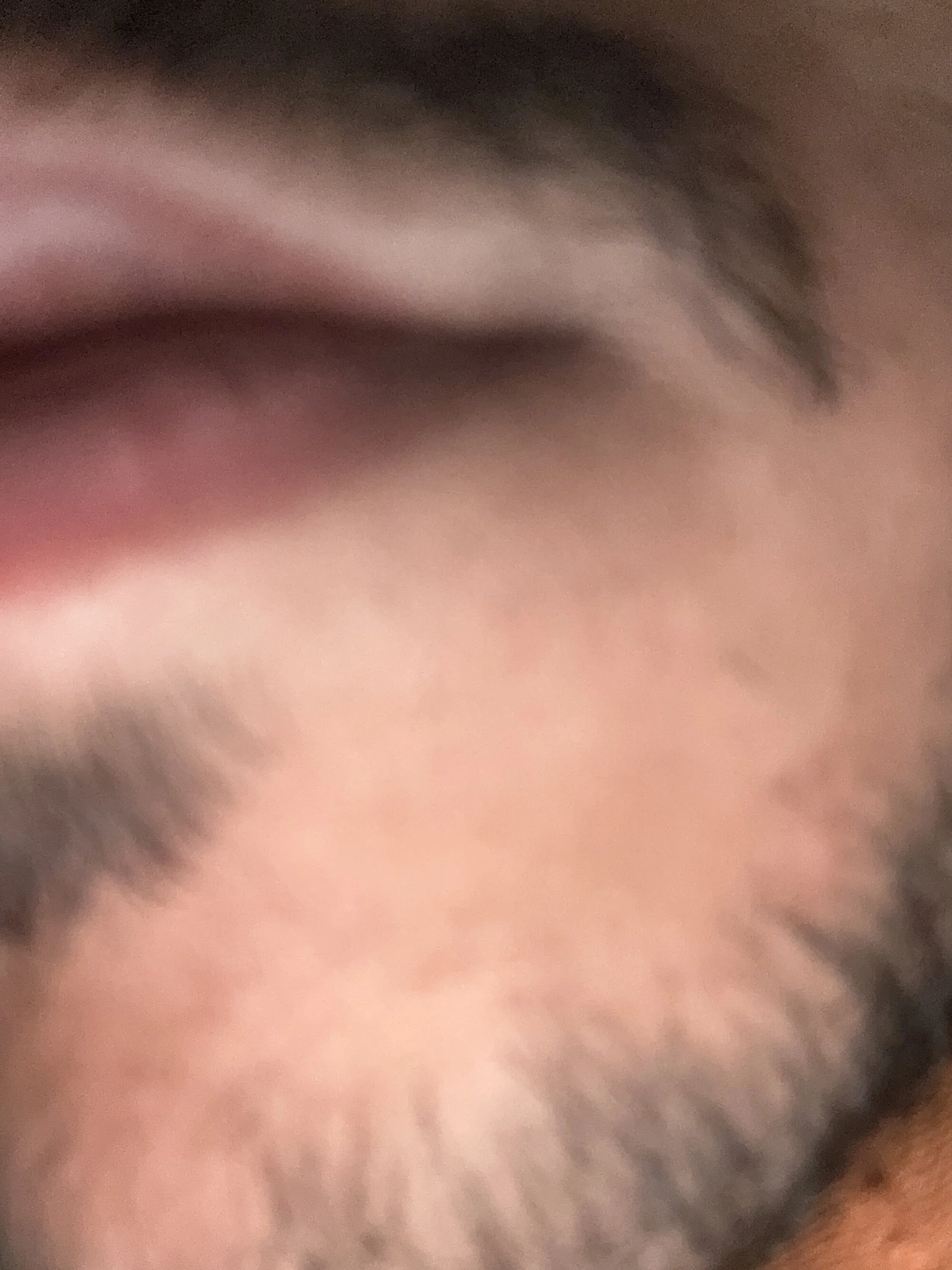 UdiAp1