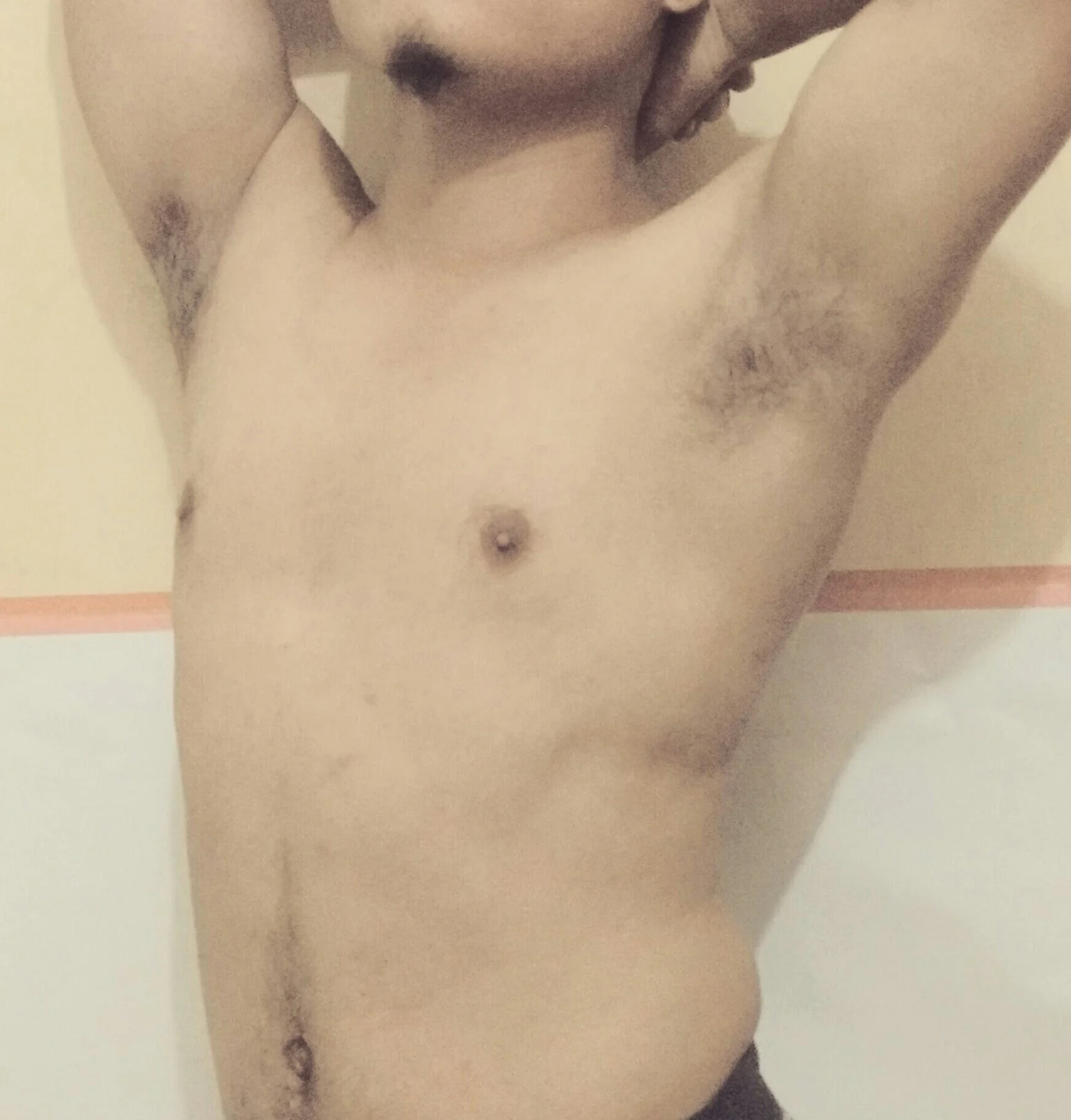 Xietoungel