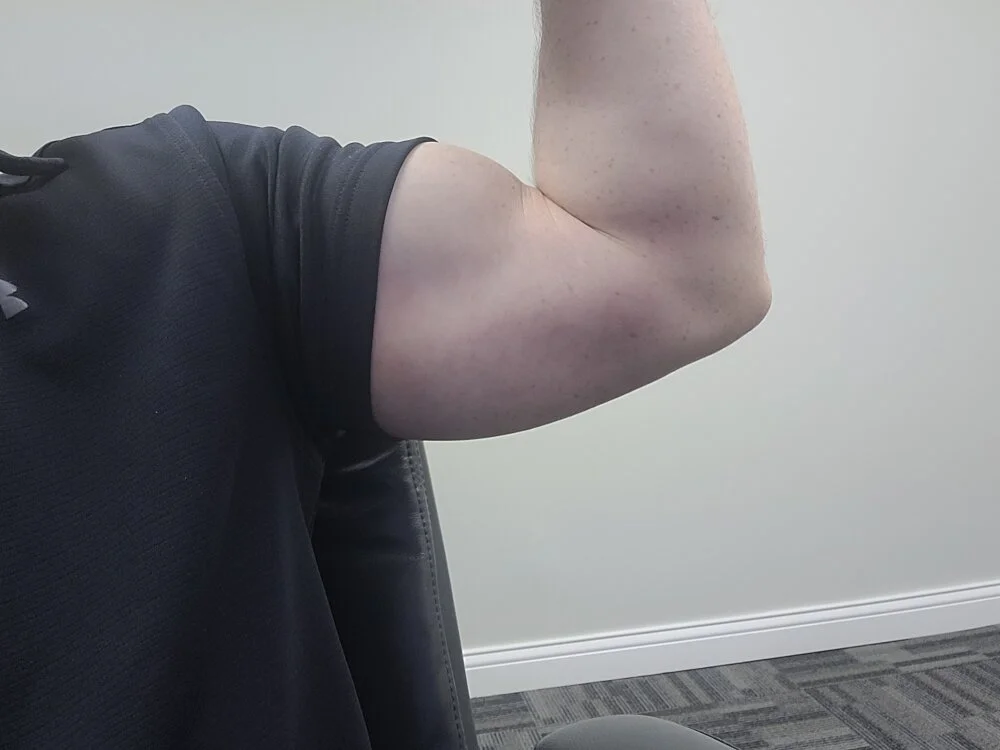 markkline 오프라인 XXX 채팅