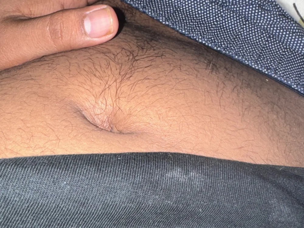 varun887