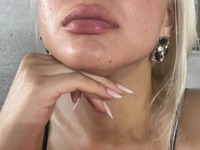 Lalolachilena profile