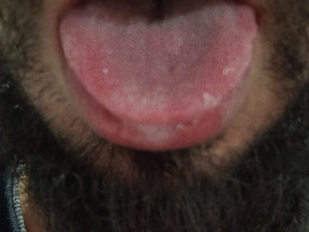 LitoralHot88