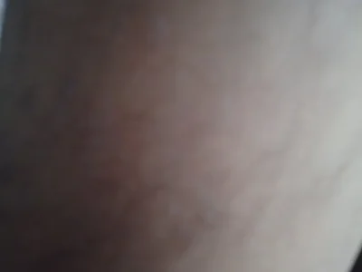 rohitelixir
