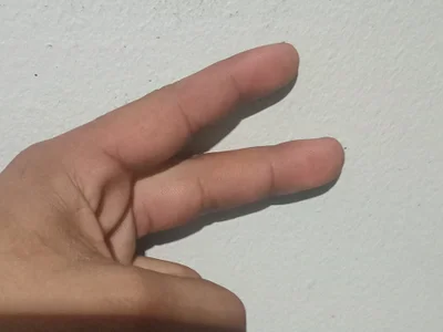 Dickson2134