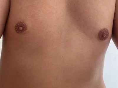 Sexxesp