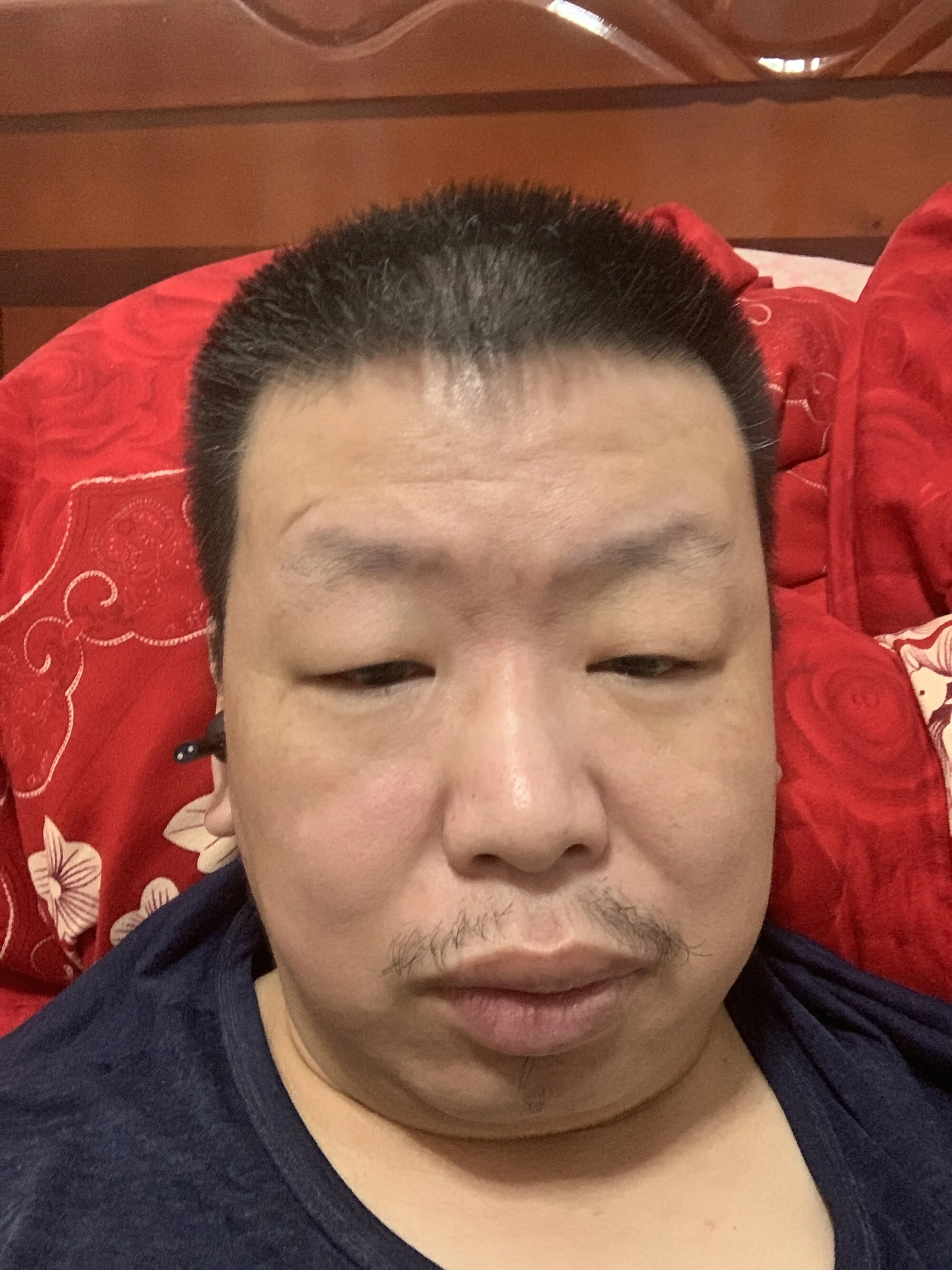 SeptalPuss
