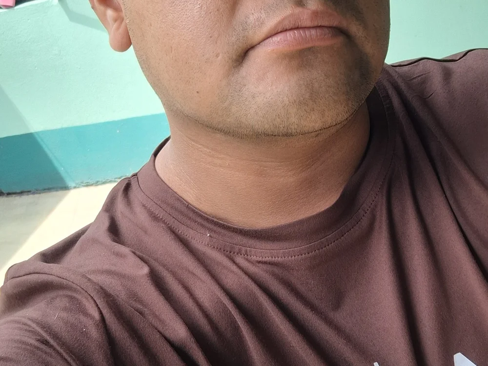 Delv000