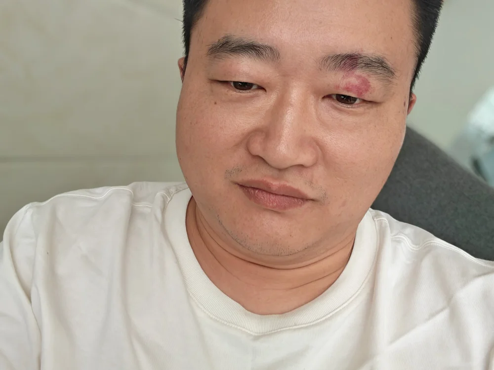Lalabu22 커버 사진