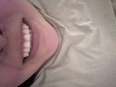 Profile of Gorditaexoticaa