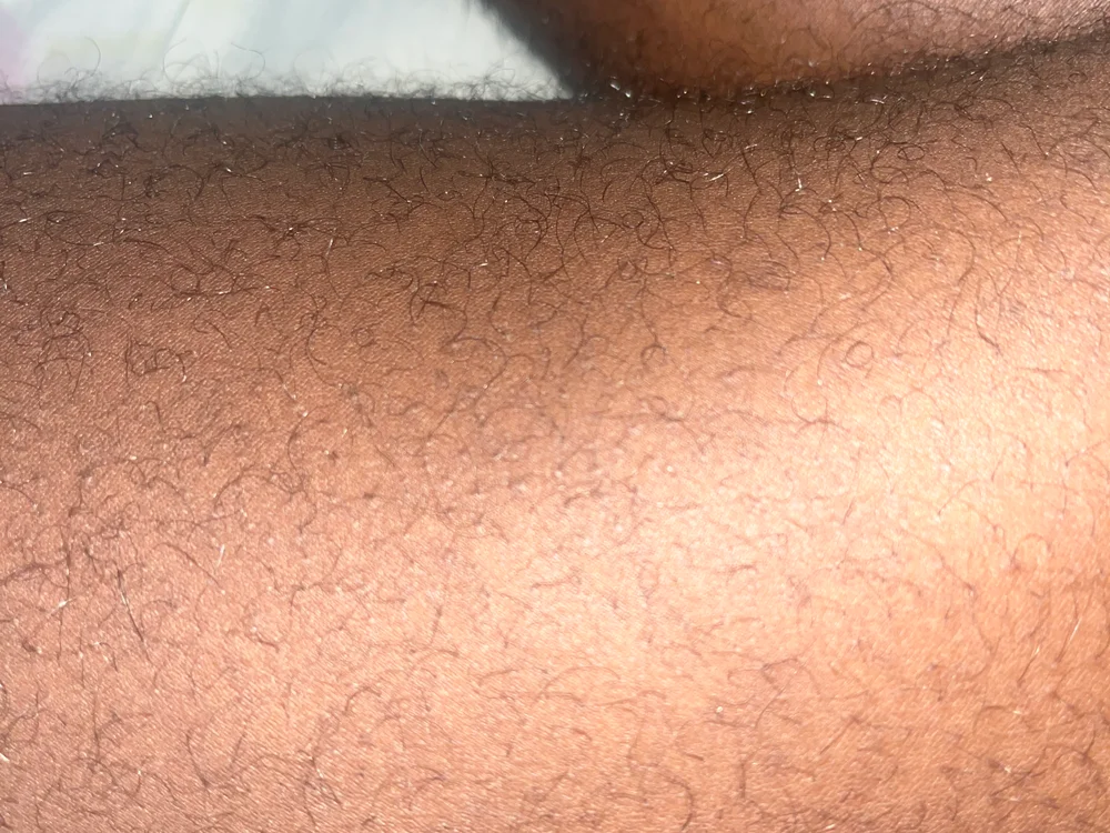 nhla21