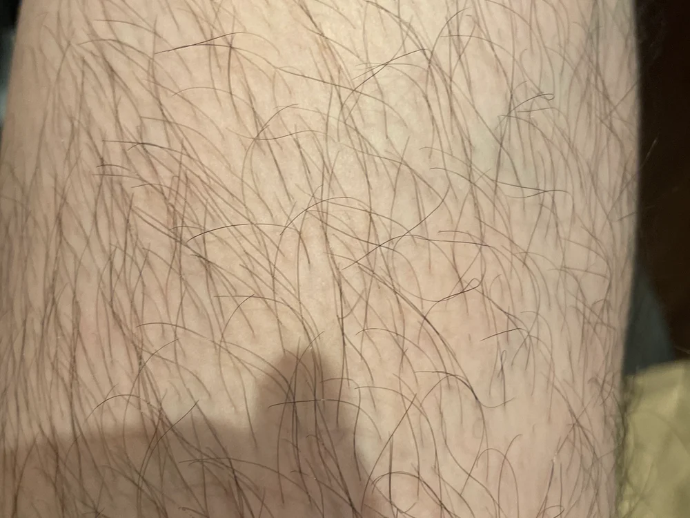 hotetahoteta