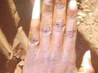 Africandccc