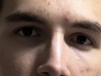 all_eyes_on_uss