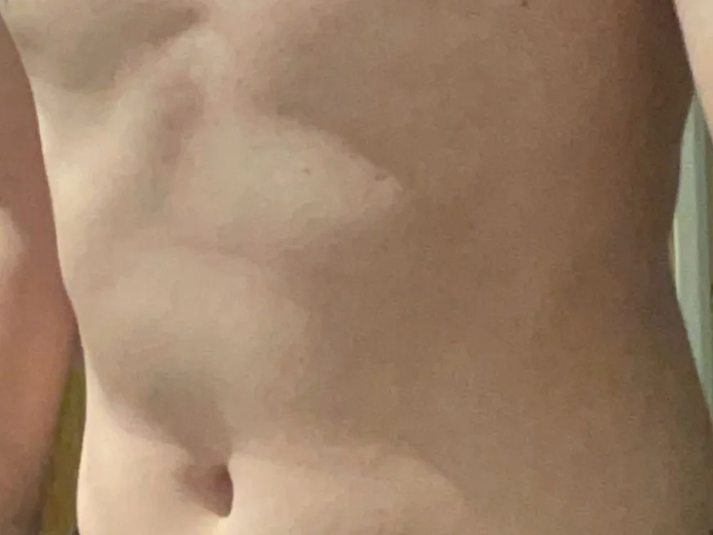 anonimm23456 2