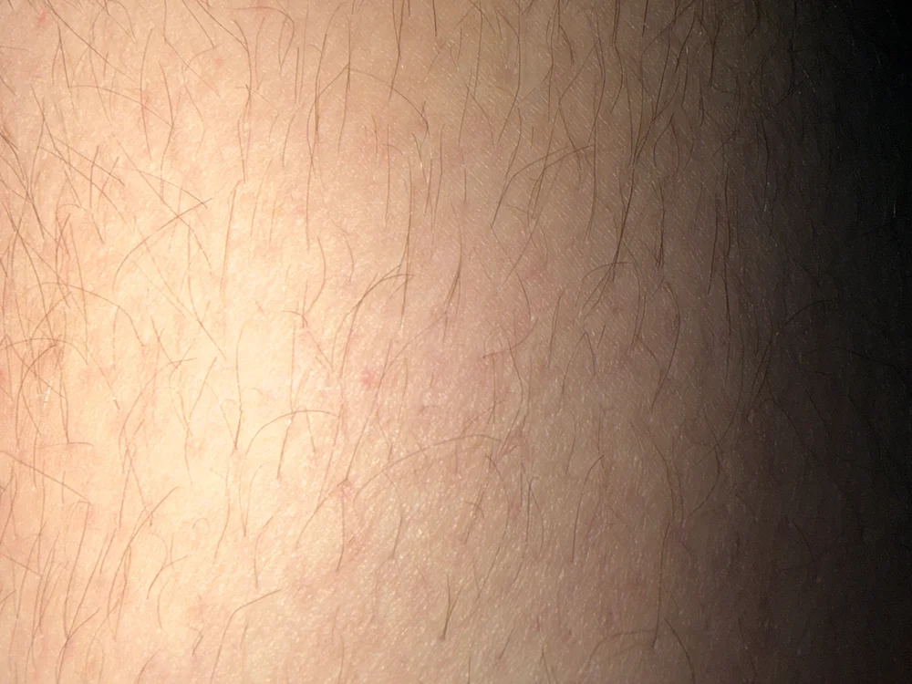 31carapuce Chat XXX offline