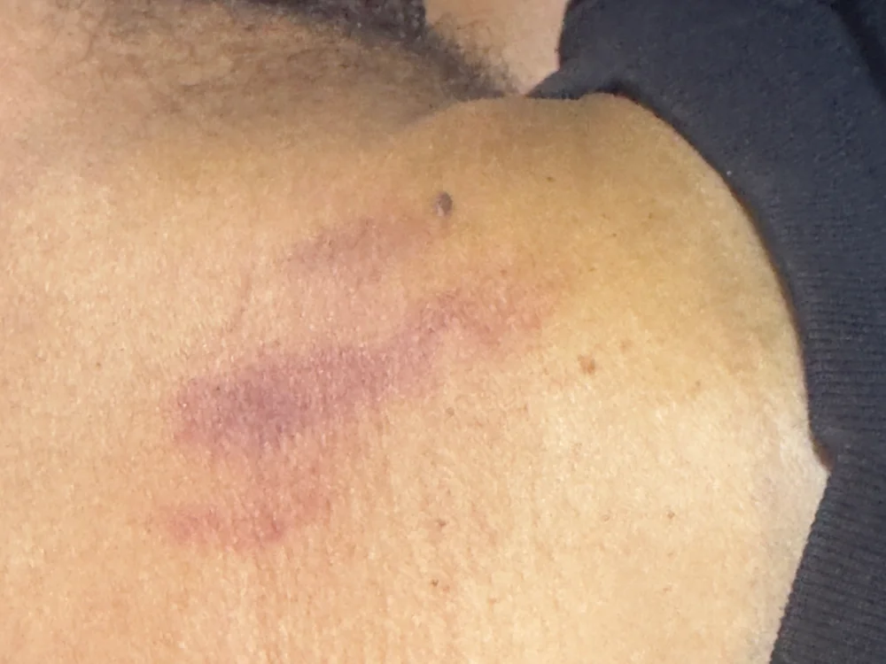 แชท XXX ออฟไลน์ของ thurstone