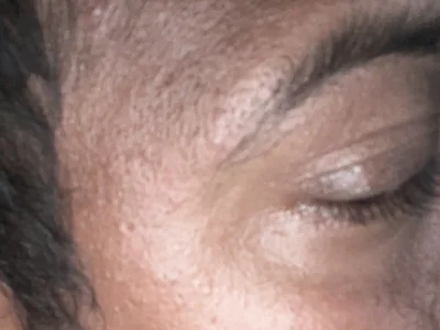Profile of desidick00