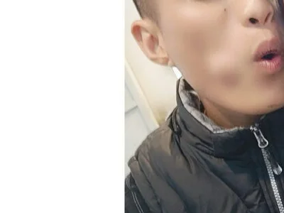 Vm60628 - Boy 