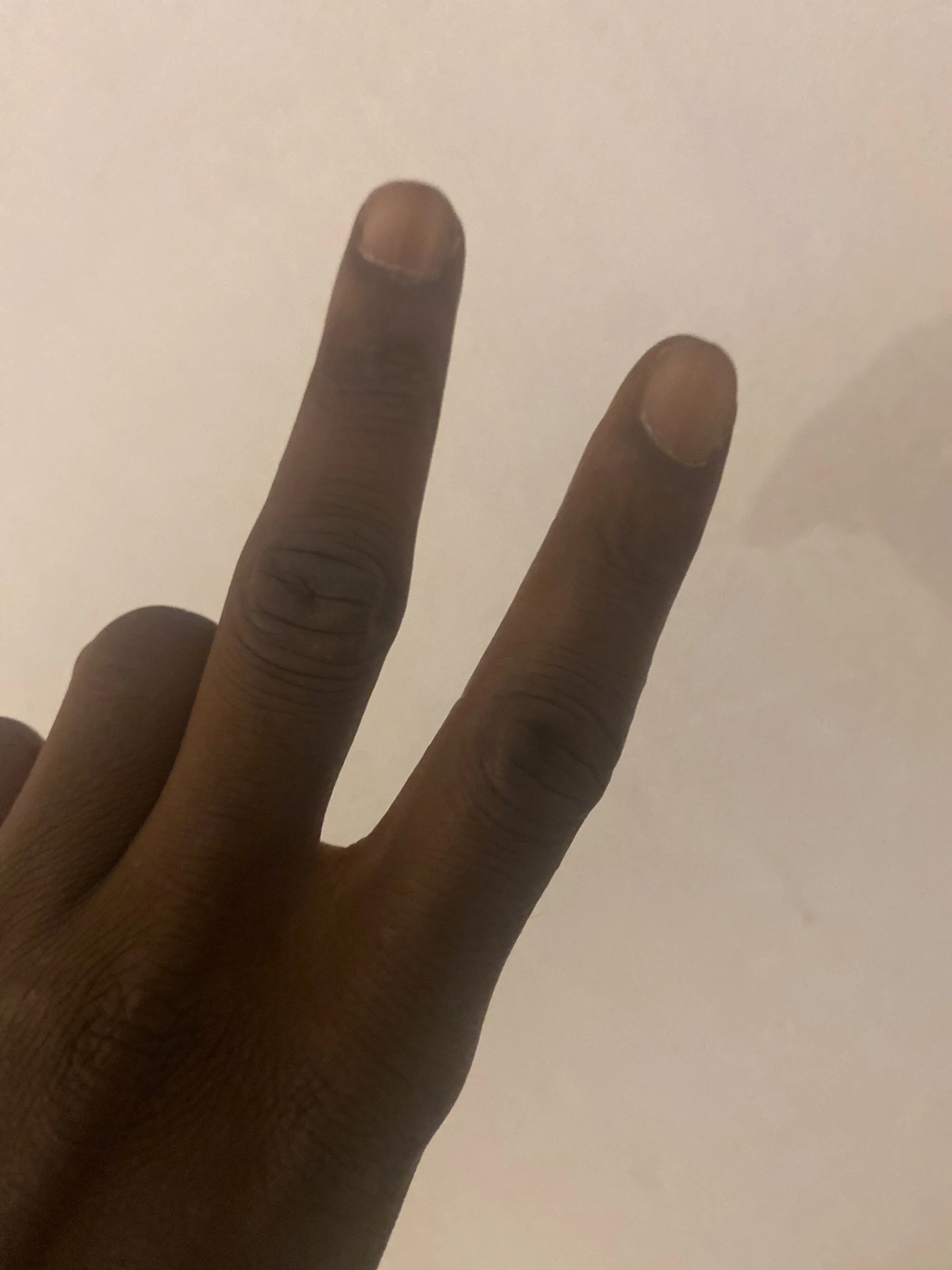 NiIgGA75