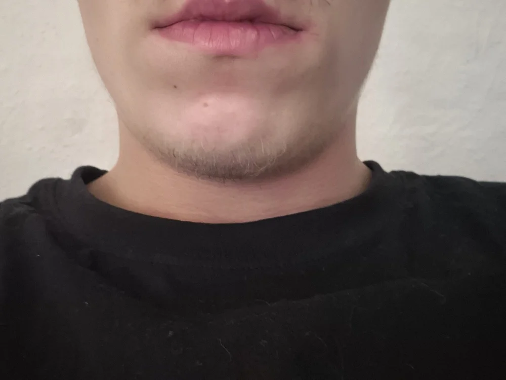 ห้องแชทออฟไลน์ของ DerAlbino