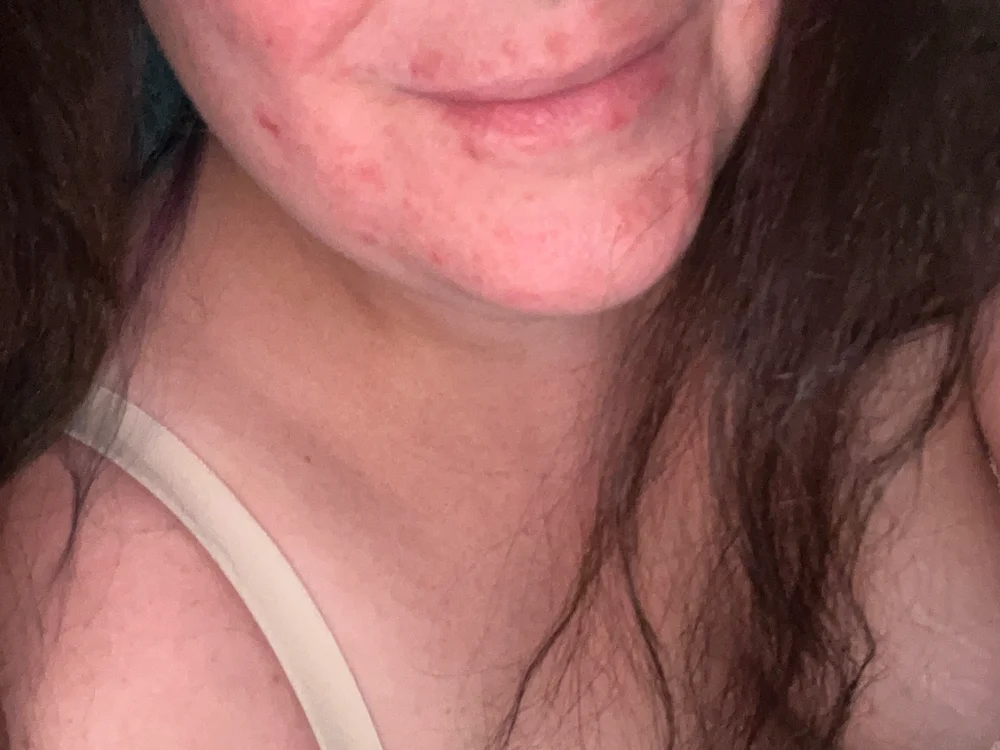 NeedyKitty47 Offline XXX-chat