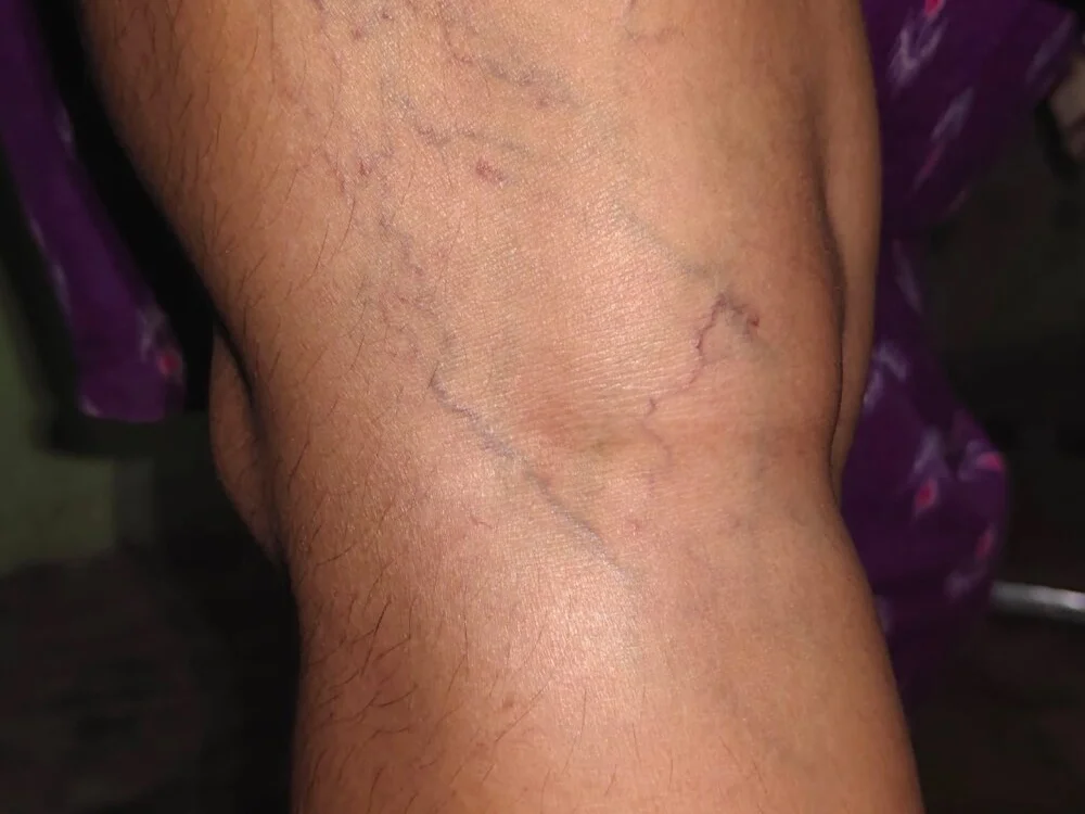 Jyothisuraj Chat XXX Ngoại tuyến