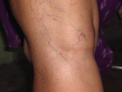 Jyothisuraj - Boy 