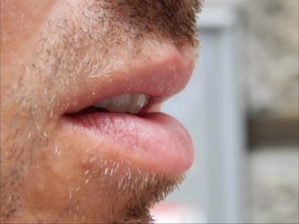 Offline XXX chat Kallobs