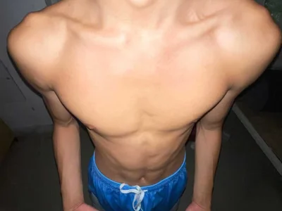 STS-BOY - Couple 