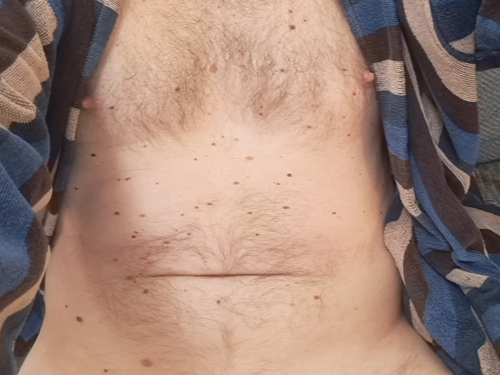 Vintermelon2 – Offline XXX chat