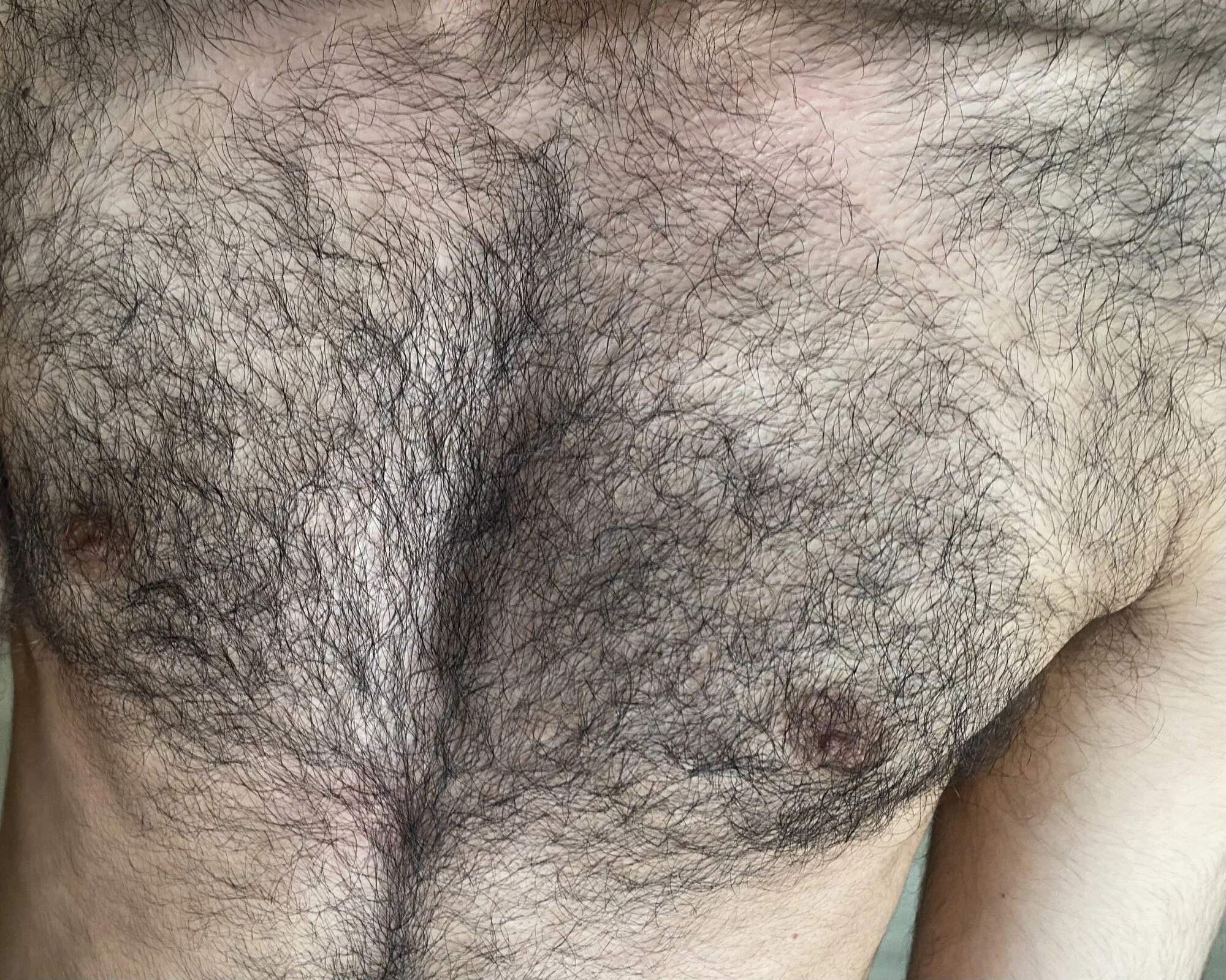 hairyprincex