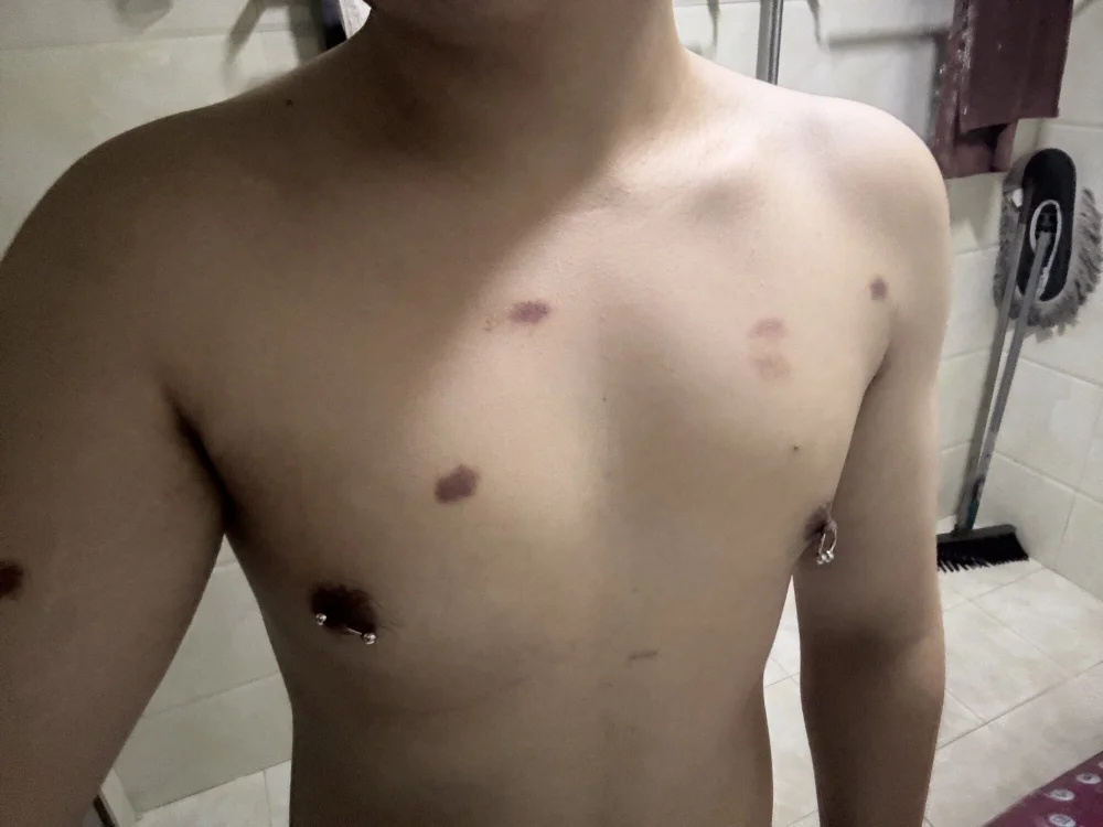 linhua-