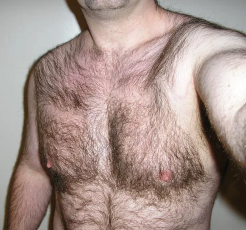 Hairyrobuk cover photo