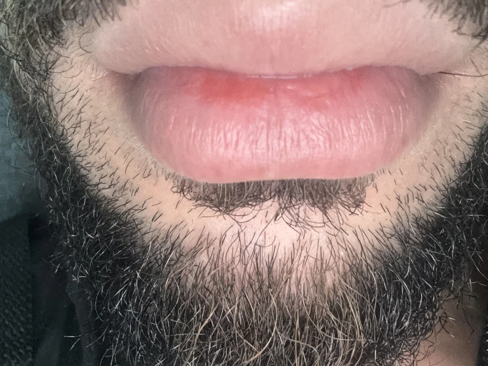 Offline XXX chat modela phellipestronda