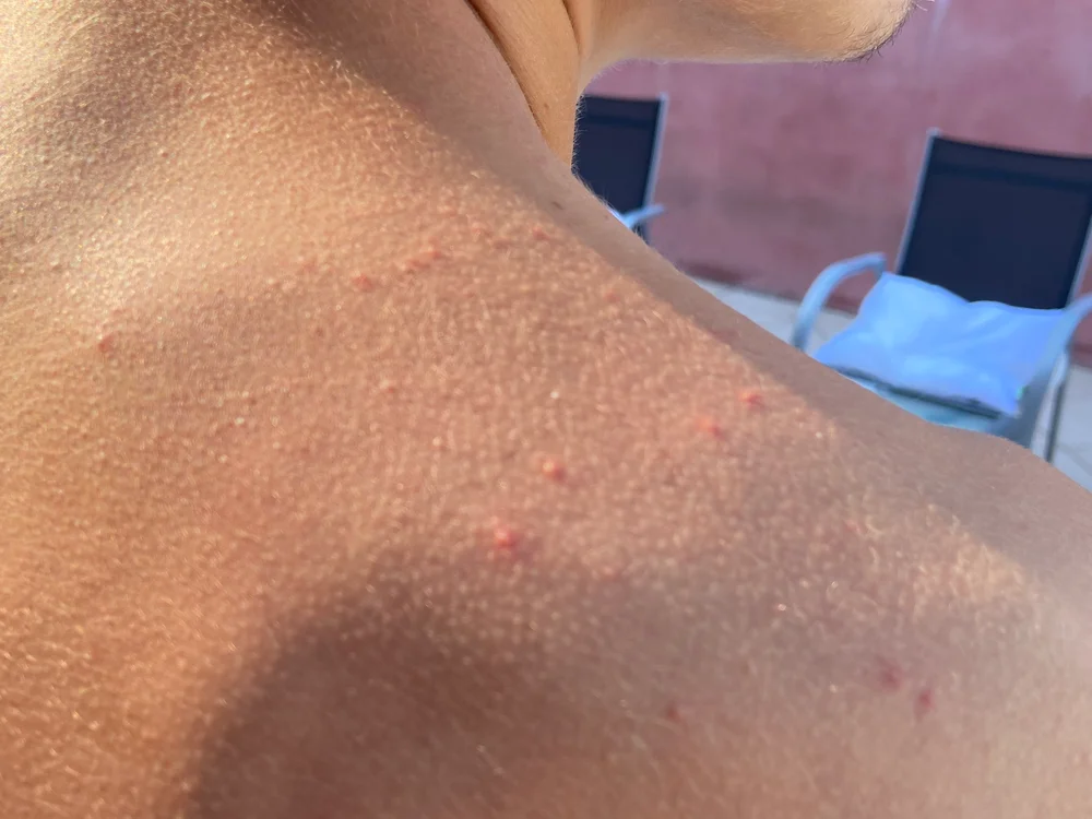 Skinny21ans Offline XXX-chat