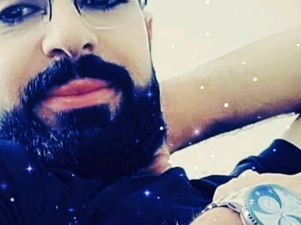 AuxeticDry cam model