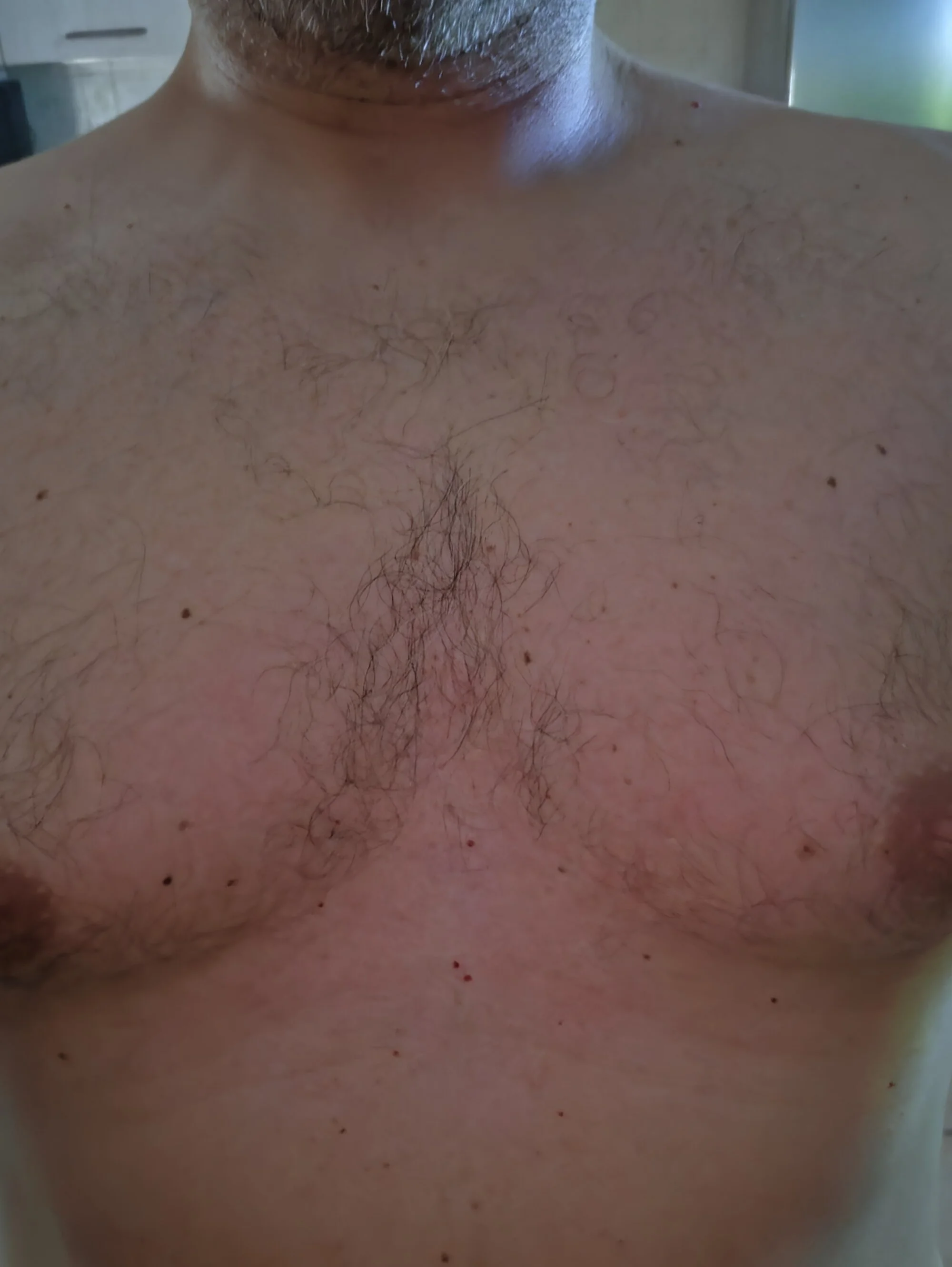 Erotico1979