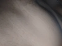 DrFv1