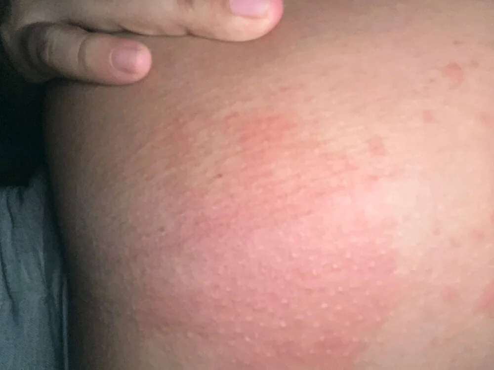 vbcm Offline XXX-chat