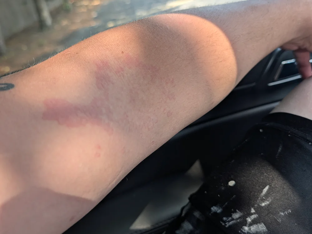Czat XXX offline – SkiedSmacking