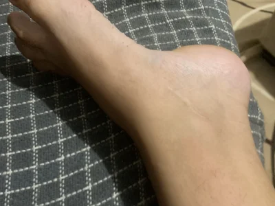 Casaldenovinho Female Analwhite Free Cam Sex
