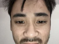 MyopicThink