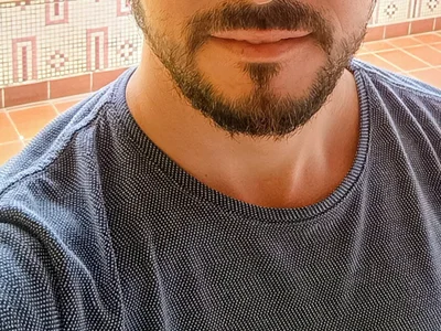 CasosAM