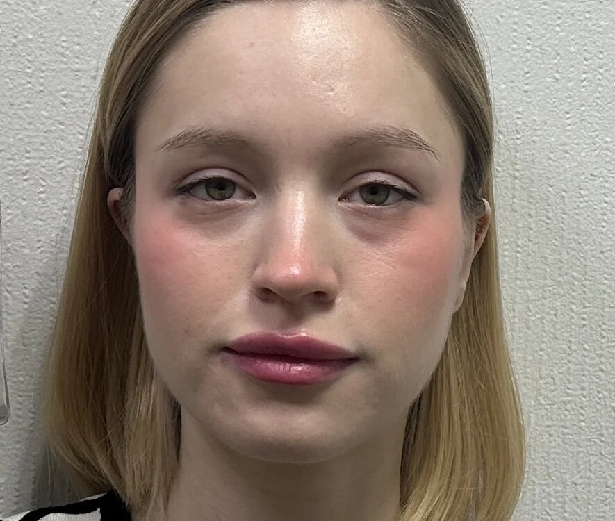 HollisGloss Cameră chat offline