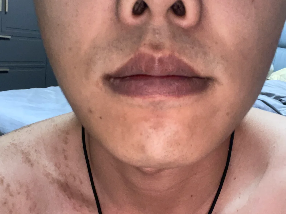 qlf1995 Chat XXX Ngoại tuyến