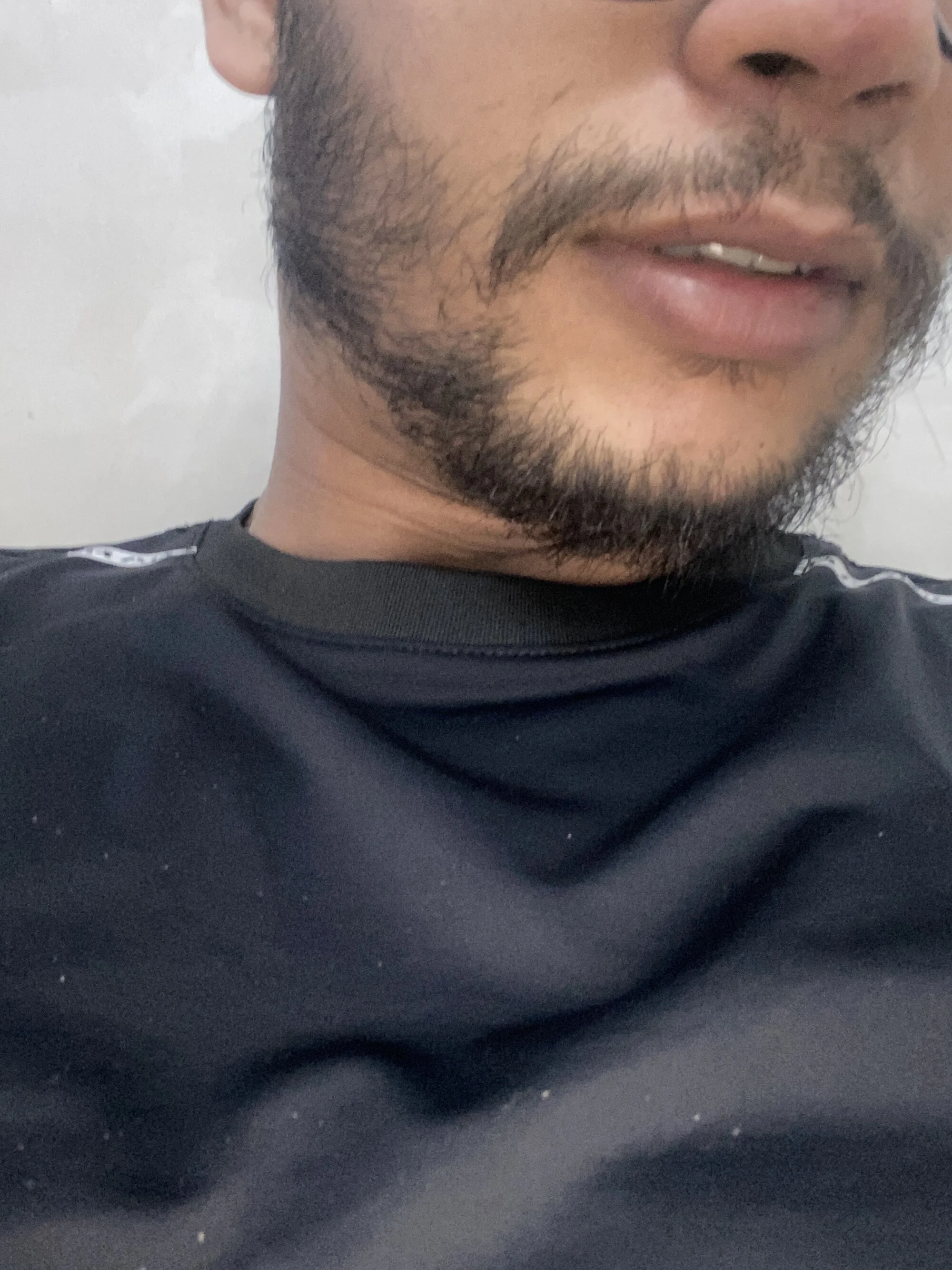 zackel00