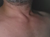appogiatura-2