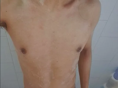 Dermental Male Mexican Live Webcam Nude
